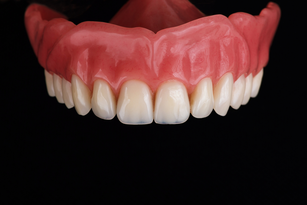 Welche Kosten kommen durch eine Zahnprothese auf mich zu?