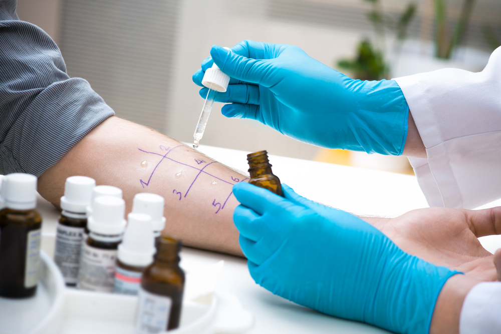 Allergietest » Mit diesen Kosten müssen sie rechnen