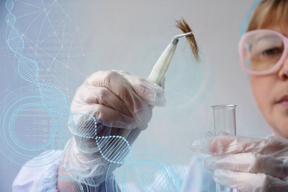 Haaranalyse Drogen Kosten