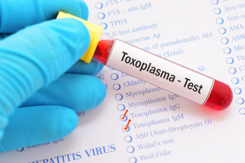 toxoplasmose-test-kosten